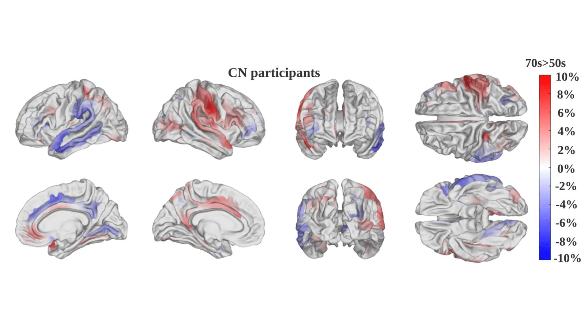 Velocidad de envejecimiento cerebral