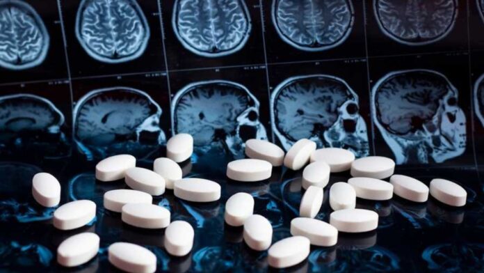 Cerebro - Envejecido - Proteína - TIMP2 - Neuroweb