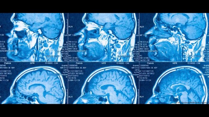 Estudio de Stanford revela el doble origen del cerebro humano