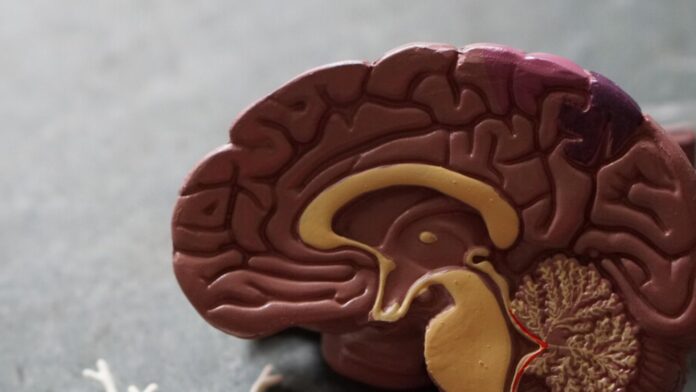Pista - Cerebros - Resisten - Alzheimer - Neuro Web